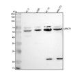 Western blot analysis of C1orf92/LRRC71 using anti-LRRC71 antibody. Lane 1: human PC-3 whole cell lysates, Lane 2: human U2OS whole cell lysates, Lane 3: rat PC-12 whole cell lysates, Lane 4: mouse NIH/3T3 whole cell lysates. After electrophoresis, proteins were transferred to a nitrocellulose membrane at 150 mA for 50-90 min. Blocked the membrane with 5% non-fat milk/TBS for 1.5 hour at RT.