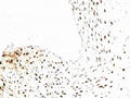 IHC testing of formalin-fixed, paraffin-embedded human cervix with L1 antibody (clone CamVir-1)