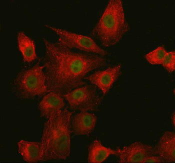 Immunofluorescent staining of SUPT20H using anti-SUPT20H antibody (green) and anti-Beta Tubulin antibody (red). SUPT20H was detected in an immunocytochemical section of cells. Enzyme antigen retrieval was performed using IHC enzyme antigen retrieval reagent for 15 mins. The cells were blocked with 10% goat serum. And then incubated with 5 ug/ml rabbit anti-SUPT20H antibody and mouse anti-Beta Tubulin antibody overnight at 4oC.