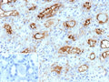 IHC staining of FFPE human kidney tissue with PD-Ibeta antibody (clone ENPP3/9892). Inset: PBS used in place of primary Ab (secondary Ab negative control). HIER: boil tissue sections in pH 9 10mM Tris with 1mM EDTA for 20 min and allow to cool before testing.