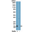 Western blot testing of acid extracts of HeLa cells, treated (+) or untreated (-) with sodium butyrate, using H2BK5ac antibody at 0.02 ug/ml.