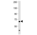 Western blot testing of mouse brain lysate with IL1RAP antibody at 1:2000. Predicted molecular weight ~65 kDa.