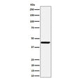 Western blot testing of human SH-SY5Y cell lysate with NODAL antibody. Predicted molecular weight ~40 kDa.
