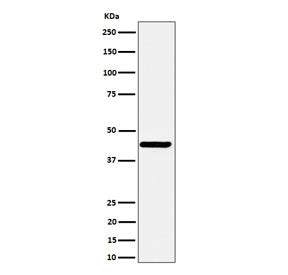 Western blot testing of human SH-SY5Y cell lysate with NODAL antibody. Predicted molecular weight ~40 kDa.