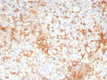 IHC staining of FFPE human adrenal gland tissue with Adipose differentiation-related protein antibody (clone rADFP/9321). HIER: boil tissue sections in pH 9 10mM Tris with 1mM EDTA for 20 min and allow to cool before testing.