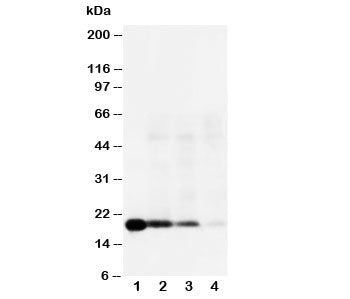 Western blot testing of IL-18 antibody and Lane 1: Recombinant human IL-18 protein 10ng; 2: 5ng; 3: 2.5ng; 4: Raji; Predicted molecular weight: 17~24 kDa