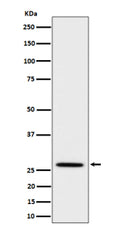Western blot analysis of Adiponectin expression in mouse kidney cell lysate using Adipoq antibody. Predicted molecular weight ~27 kDa.