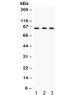 Western blot testing of human 1) A431, 2) 22RV1 and 3) COLO320 lysate with GCN5 antibody. Expected/observed molecular weight ~94 kDa.