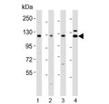 Western blot testing of 1) human RD, 2) human HeLa, 3) rat liver and 4) human testis lysate with VCL antibody. Predicted molecular weight ~124 kDa.