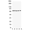 Western blot testing of Kv1.4 antibody and Lane 1: rat brain; 2: human HY1080; 3: (h) PANC; 4: (h) U87; 5: (h) SHG-44 lysate