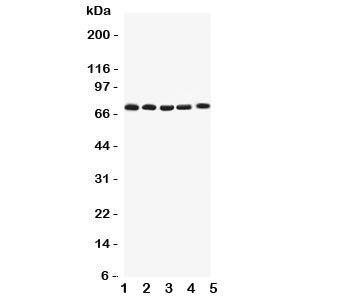 Western blot testing of Kv1.4 antibody and Lane 1: rat brain; 2: human HY1080; 3: (h) PANC; 4: (h) U87; 5: (h) SHG-44 lysate