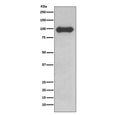 Western blot testing of human Ramos cell lysate with CD19 antibody. Expected molecular weight: 60-100 kDa depending on glycosylation level.