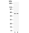 Western blot testing of human 1) PANC and 2) Jurkat cell lysate with SKAP55 antibody. Predicted molecular weight ~41 kDa but routinely observed at ~55 kDa.