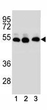 TUBB2B antibody western blot analysis of (1) human HepG2, (2) human HeLa, (3) human MDA-MB-231 cell lysate.
