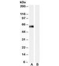 Western blot testing of human muscle lysate with SNTA1 antibody at 0.01ug/ml with [B] and without [A] blocking/immunizing peptide. Predicted molecular weight: ~54kDa.