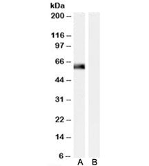Western blot testing of human muscle lysate with SNTA1 antibody at 0.01ug/ml with [B] and without [A] blocking/immunizing peptide. Predicted molecular weight: ~54kDa.