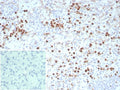 IHC staining of FFPE human spleen tissue with recombinant LAMP-3 antibody (clone rLAMP3/9131). Inset: PBS used in place of primary Ab (secondary Ab negative control). HIER: boil tissue sections in pH 9 10mM Tris with 1mM EDTA for 20 min and allow to cool before testing.