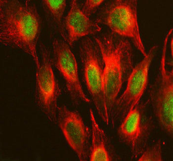 Immunofluorescent staining of RPS19BP1 using anti-RPS19BP1 antibody (green) and anti-Beta Tubulin antibody (red). RPS19BP1 was detected in an immunocytochemical section of U2OS cells. Enzyme antigen retrieval was performed using IHC enzyme antigen retrieval reagent for 15 mins. The cells were blocked with 10% goat serum. And then incubated with 5 ug/ml rabbit anti-RPS19BP1 antibody and mouse anti-Beta Tubulin antibody overnight at 4oC.