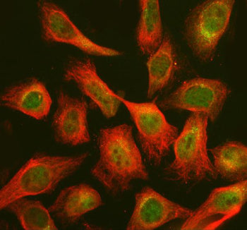 Immunofluorescent staining of CHP2 using anti-CHP2 antibody (green) and anti-Beta Tubulin antibody (red). CHP2 was detected in an immunocytochemical section of Hela cells. Enzyme antigen retrieval was performed using IHC enzyme antigen retrieval reagent for 15 mins. The cells were blocked with 10% goat serum. And then incubated with 5 ug/ml rabbit anti-CHP2 antibody and mouse anti-Beta Tubulin antibody overnight at 4oC.