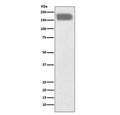 Western blot testing of human SH-SY5Y cell lysate with NCAM1 antibody. Predicted molecular weight: ~110 kDa (soluble fragment), ~120/125 kDa (GPI-anchored), 140/180 kDa (transmembrane isoforms).