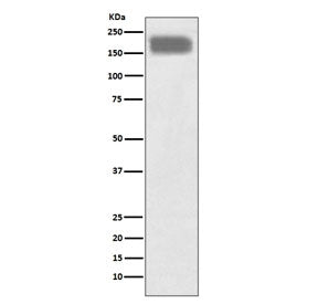 Western blot testing of human SH-SY5Y cell lysate with NCAM1 antibody. Predicted molecular weight: ~110 kDa (soluble fragment), ~120/125 kDa (GPI-anchored), 140/180 kDa (transmembrane isoforms).