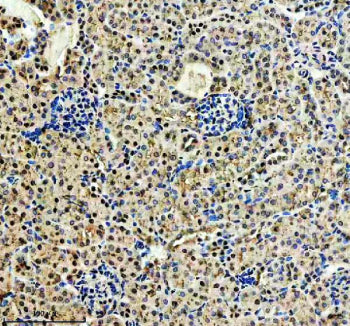 Immunohistochemical staining of CDK2(Phospho-T160)/CDK1(Phospho-T161) using anti-Phospho-CDK2/CDK1 (Thr160/Thr161) antibody. CDK2(Phospho-T160)/CDK1(Phospho-T161) was detected in a paraffin-embedded section of mouse kidney tissue. Heat mediated antigen retrieval was performed in EDTA buffer (pH 8.0, epitope retrieval solution). The tissue section was blocked with 10% goat serum. The tissue section was then incubated with a dilution of 1:50 rabbit anti-Phospho-CDK2/CDK1 (Thr160/Thr161) antibody overnight at