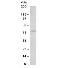 Western blot testing of NIH3T3 lysate with IL7R antibody at 2ug/ml. Predicted molecular weight: ~51/60-90kDa (unmodified/glycosylated).