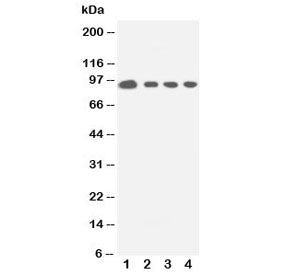 Western blot testing of human 1: HeLa; 2: COLO320; 3: Jurkat; 4: CEM cell lysate with STAT5a antibody. Predicted molecular weight: ~91 kDa.