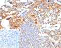 IHC staining of FFPE human tonsil tissue with MIG9 antibody (clone S100P/7374). Inset: PBS used in place of primary Ab (secondary Ab negative control). HIER: boil tissue sections in pH 9 10mM Tris with 1mM EDTA for 20 min and allow to cool before testing.