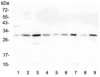 Western blot testing of 1) rat liver, 2) rat lung, 3) rat pancreas, 4) rat stomach, 5) mouse lung, 6) mouse liver, 7) mouse pancreas, 8) mouse stomach and 9) mouse small intestine lysate with RPS3 antibody at 0.5ug/ml. Predicted molecular weight ~27 kDa.