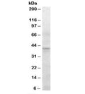Western blot testing of human pancreas lysate with SERPINI2 antibody at 0.3ug/ml. Predicted molecular weight: ~46kDa, observed here at ~40kDa.