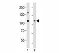 Western blot analysis of lysate from (1) HeLa cell line and (2) human skeletal muscle tissue using Dnmt3a antibody at 1:1000. Predicted molecular weight: 100-130 kDa