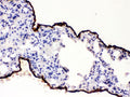 IHC testing of FFPE mouse lung with Mesothelin antibody. HIER: Boil the paraffin sections in pH 6, 10mM citrate buffer for 20 minutes and allow to cool prior to staining.