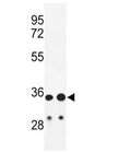 Western blot analysis of IGH antibody and HL-60, A2058 lysate.