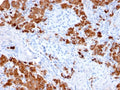 IHC testing of FFPE human pancreas with Carboxypeptidase A1 antibody (clone CPA1/2712). HIER: boil tissue sections in pH6, 10mM citrate buffer, for 10-20 min followed by cooling at RT for 20 min.