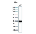 Western blot testing of human Raji cell lysate with CD74 antibody. Expected molecular weight: 33-43 kDa.