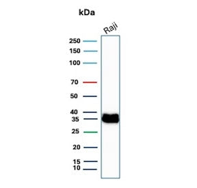 Western blot testing of human Raji cell lysate with CD74 antibody. Expected molecular weight: 33-43 kDa.