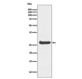 Western blot testing of human kidney lysate with Histone H1.0 antibody. Predicted molecular weight ~20 kDa but can be observed at up to ~30 kDa.