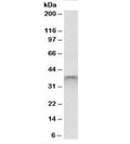 Western blot testing of human testis lysate with SPO11 antibody at 1ug/ml. Predicted molecular weight: ~40kDa.