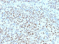 IHC staining of FFPE human bladder tissue with recombinant p27Kip1 antibody (clone clone KIP1/1355R) at 2ug/ml. HIER: boil tissue sections in pH 9 10mM Tris with 1mM EDTA for 20 min and allow to cool before testing. Strong nuclear staining observed.