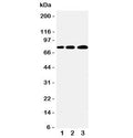 Western blot testing of PLK2 antibody and Lane 1: A431; 2: 293T; 3: COLO320 cell lysate. Predicted molecular weight ~78 kDa.