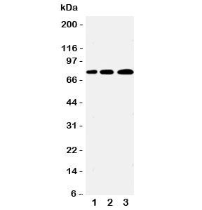Western blot testing of PLK2 antibody and Lane 1: A431; 2: 293T; 3: COLO320 cell lysate. Predicted molecular weight ~78 kDa.