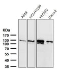 Western blot testing of human samples using the PALLD antibody at 1:3000 dilution for 1 hour at room temperature. PALLD antibody detects a band migrating at ~125-135 kDa in the indicated cell lysates, consistent with the 140-kDa Palladin isoform. Minor gel-to-gel variation reflects phosphorylation-dependent mobility and cytoskeletal protein behavior. Lower fragments (when present) are attributed to regulated proteolysis.