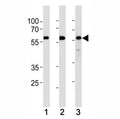 KLF4 antibody western blot analysis in (1) HeLa,(2) MCF-7 and (3) SW480 lysate. Predicted molecular weight: 50-60 kDa + possible ~75 kDa (phosphorylated form).