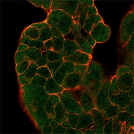 Immunofluorescent staining of PFA-fixed human MCF-7 cells BTF2 p44 antibody (green, clone PCRP-GTF2H2-1B9) and phalloidin (red).