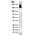 Western blot testing of human spleen lysate with recombinant CD45RA antibody. Expected molecular weight: 147-220 kDa depending on glycosylation level.
