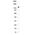 Western blot testing of ZEB2 antibody and SMMC-7721 lysate. Predicted molecular weight 120~136 kDa.