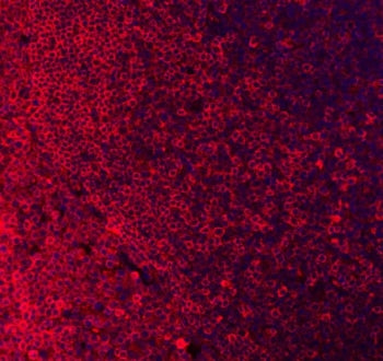 Immunofluorescent staining of FFPE human tonsil tissue with CD79a antibody (red) and DAPI nuclear stain (blue). HIER: boil tissue sections in pH8 EDTA for 20 min and allow to cool before testing.