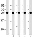 Western blot testing of human 1) HeLa, 2) Jurkat, 3) MCF-7, 4) U-2OS and 5) A431 cell lysate with RPL14 antibody at 1:2000. Predicted molecular weight: 23 kDa.