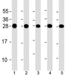Western blot testing of human 1) HeLa, 2) Jurkat, 3) MCF-7, 4) U-2OS and 5) A431 cell lysate with RPL14 antibody at 1:2000. Predicted molecular weight: 23 kDa.